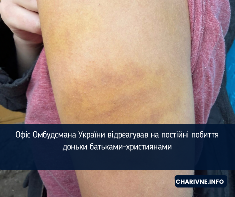Фото ілюстративне